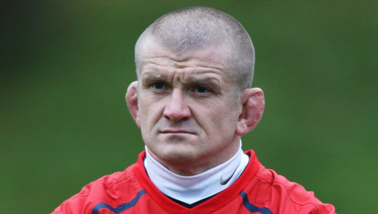 Cauliflower Ears: Rugby’s Iconic Condition