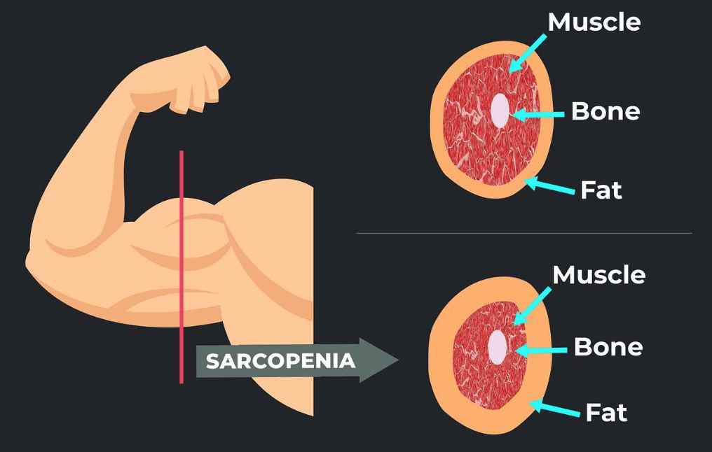 muscle bone fat